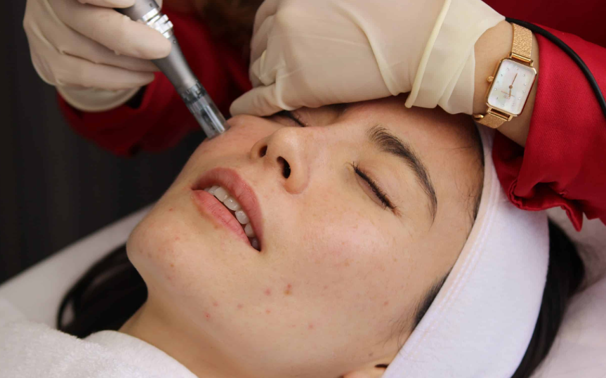 Get Non-surgical Facelifts with Medispa and Ultraformer in Auckland
