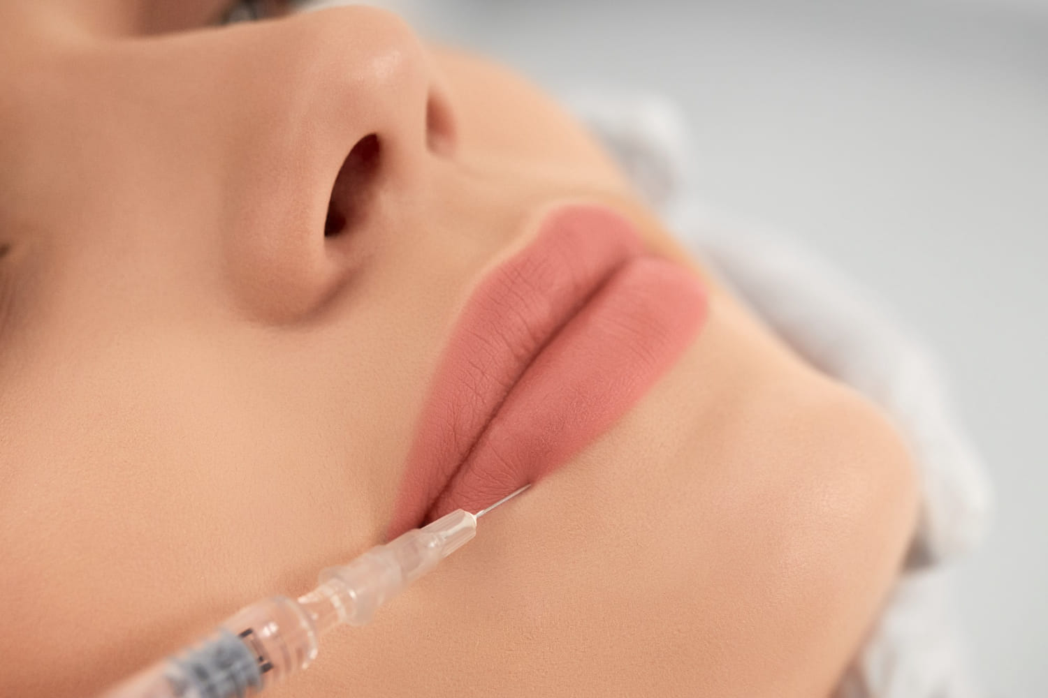 Lip Fillers: What You Need to Know Before You Book